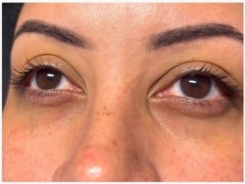 Before a lash lift and tint: straight natural lashes with no curl